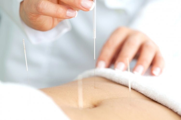 acupuntura ajuda a fertilidade