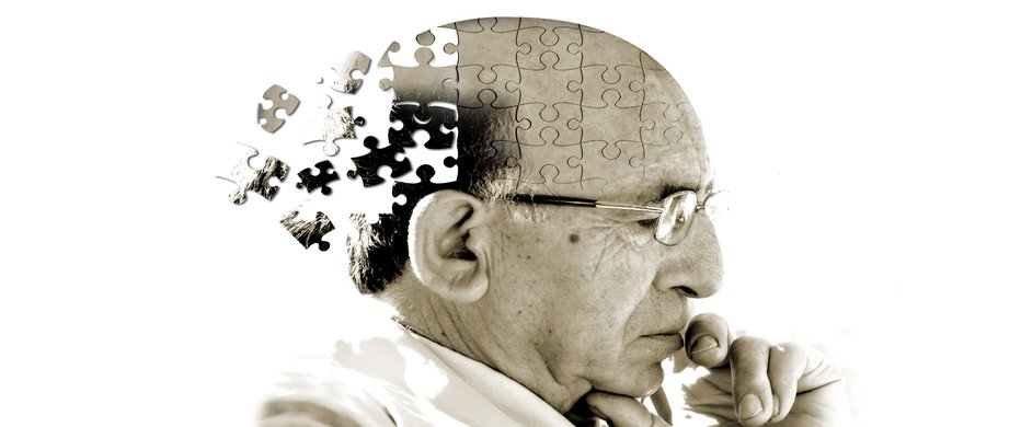 sintomas de Alzheimer