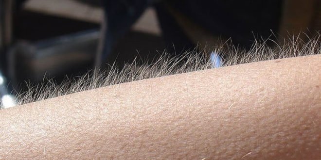 Porque nos arrepiamos