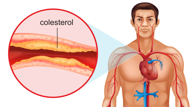 5 Passos para Reduzir o Colesterol