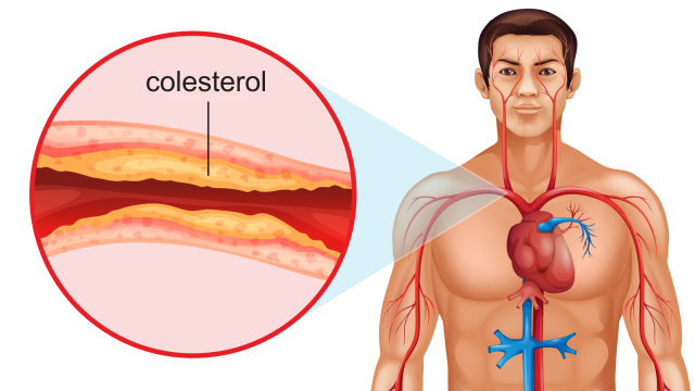 como reduzir o colesterol