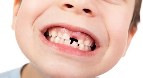Porque existe dentição de leite e dentição definitiva?