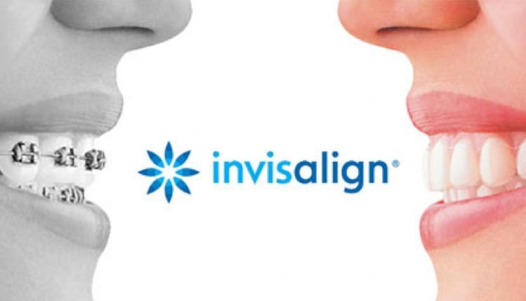 Dentes alinhados sem aparelho fixo: é possível com Invisalign! Ortodôntia invisível