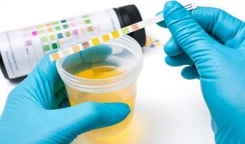 interpretar analises de urina