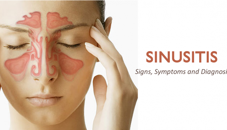 Sinusite  – Causas, sintomas e tratamento natural