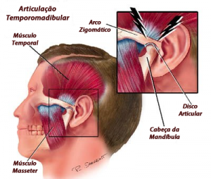 disfunção temporomandibular