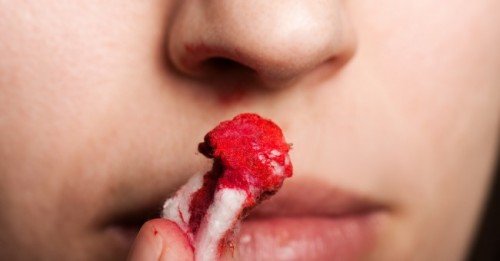 O que causa sangramento no nariz
