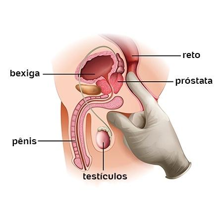 cancro da próstata