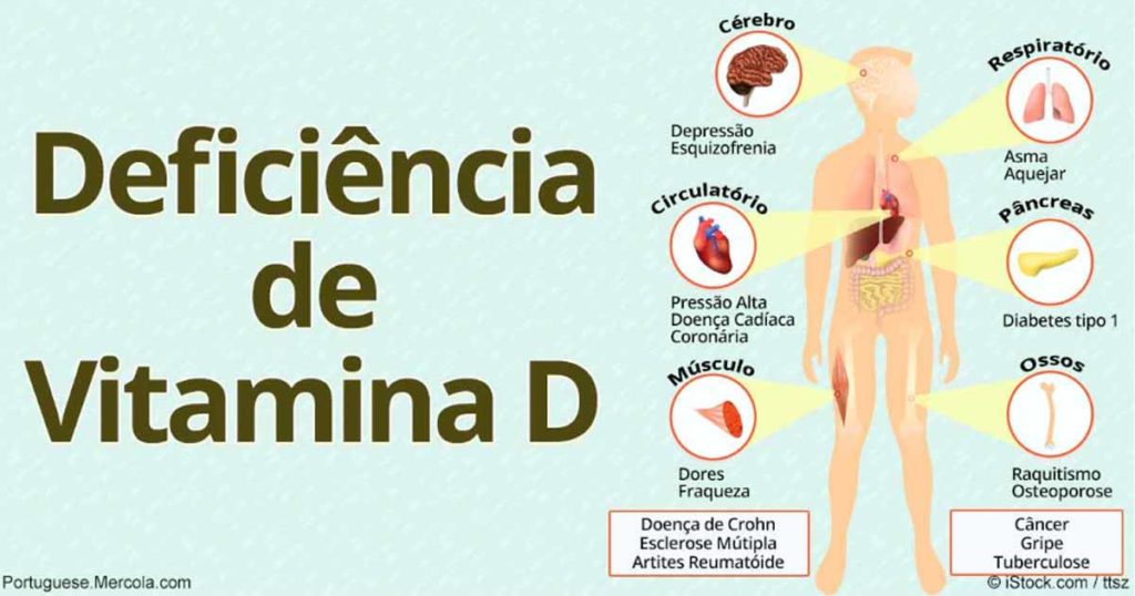 deficiência de vitamina D