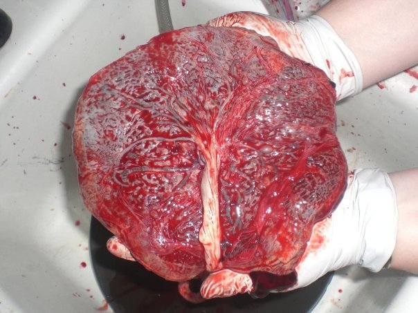 placenta