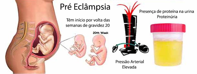 pré-eclampsia sintomas